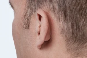 OTICON OWN™ ITE FS - Salaj Akustik
