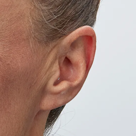 OTICON OWN SI™ IIC - Image 6